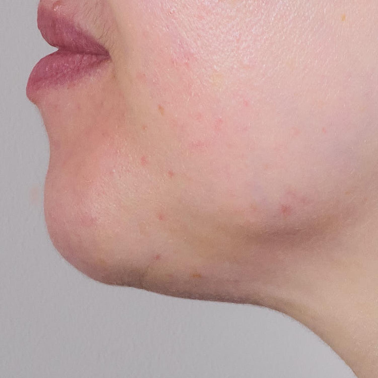 Result after only 4 weeks of use