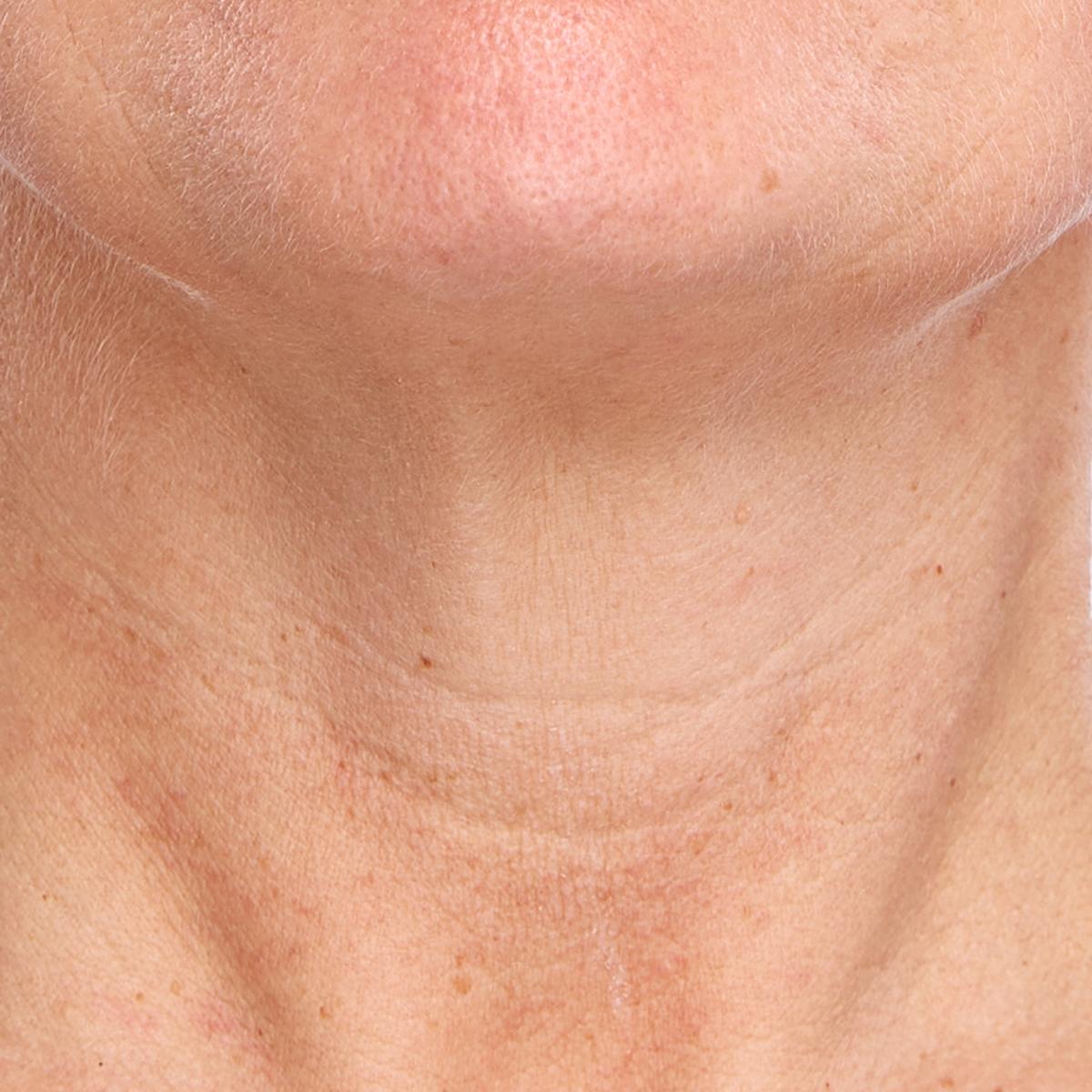 Beschrijving afbeelding 1