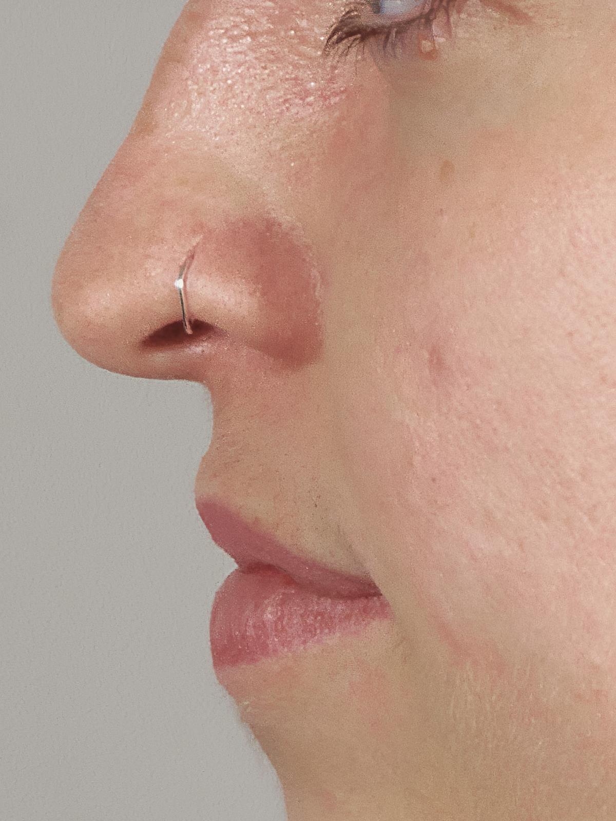 Result after only 4 weeks of use