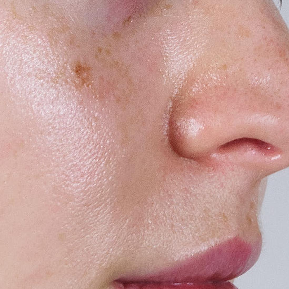 Result after only 4 weeks of use