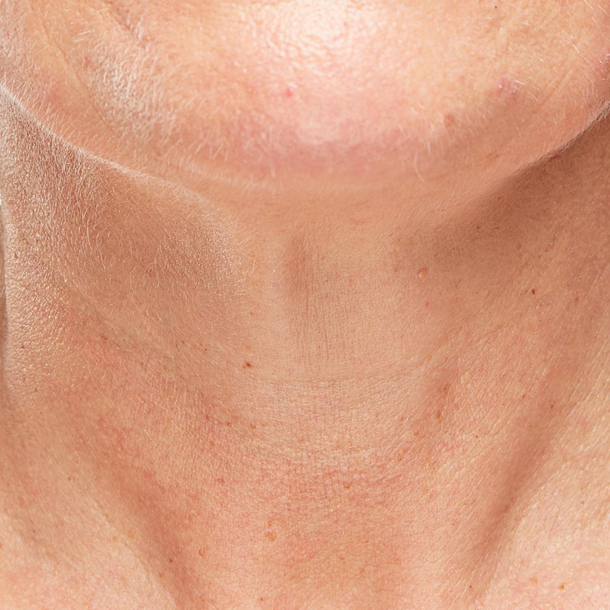 Beschrijving afbeelding 2