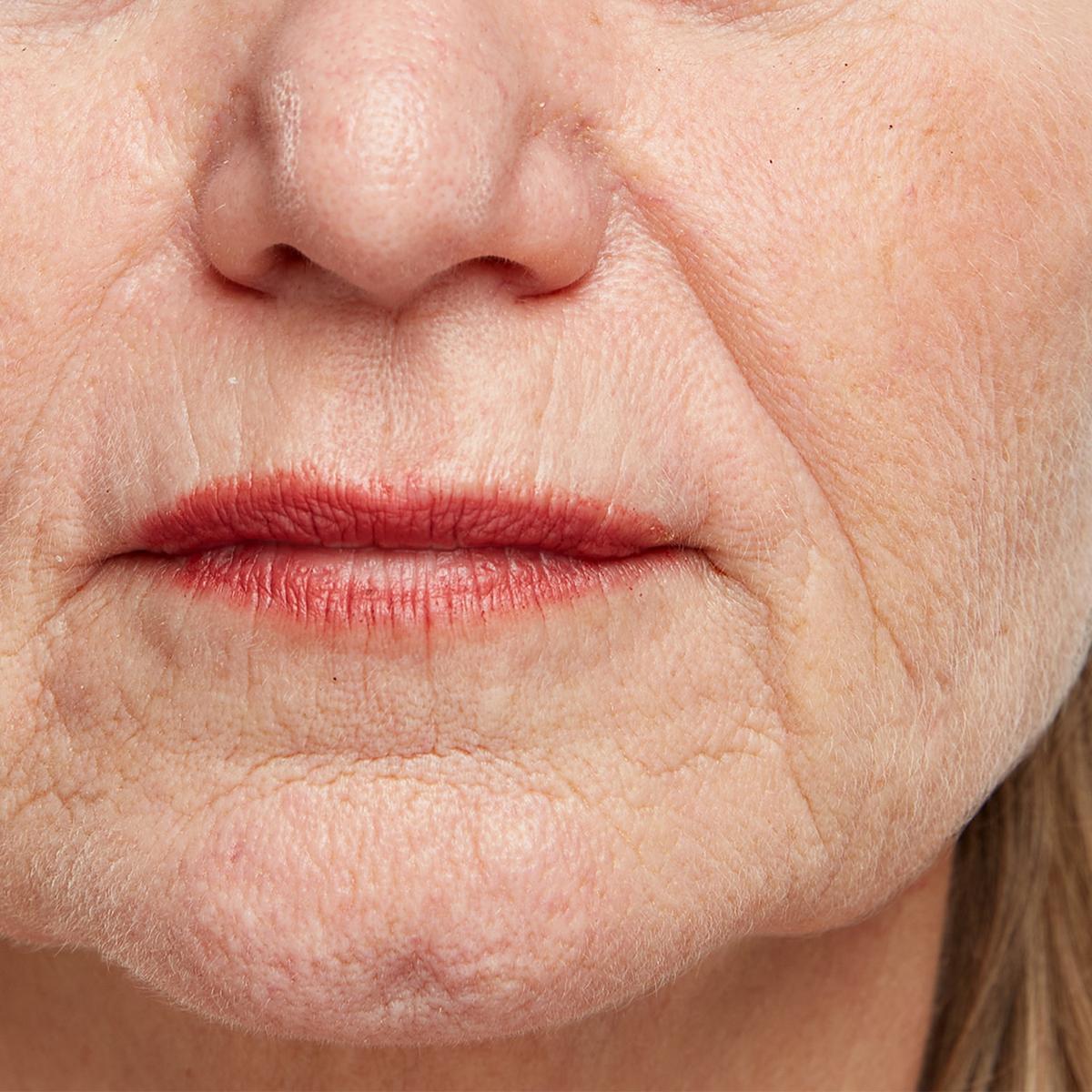 Beschrijving afbeelding 1