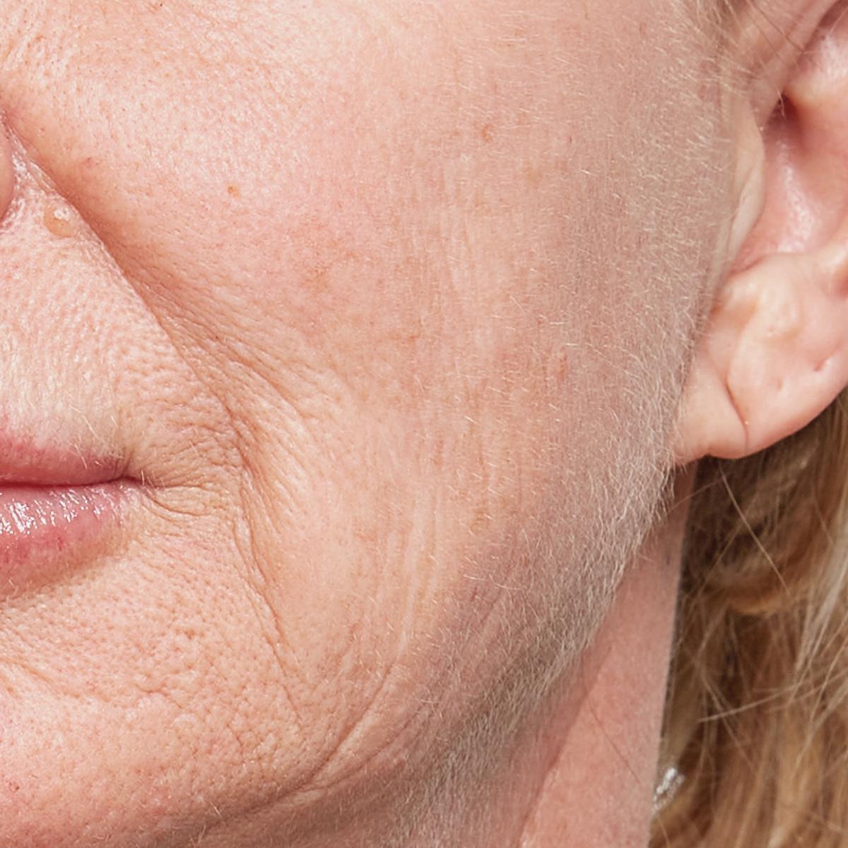 Beschrijving afbeelding 2