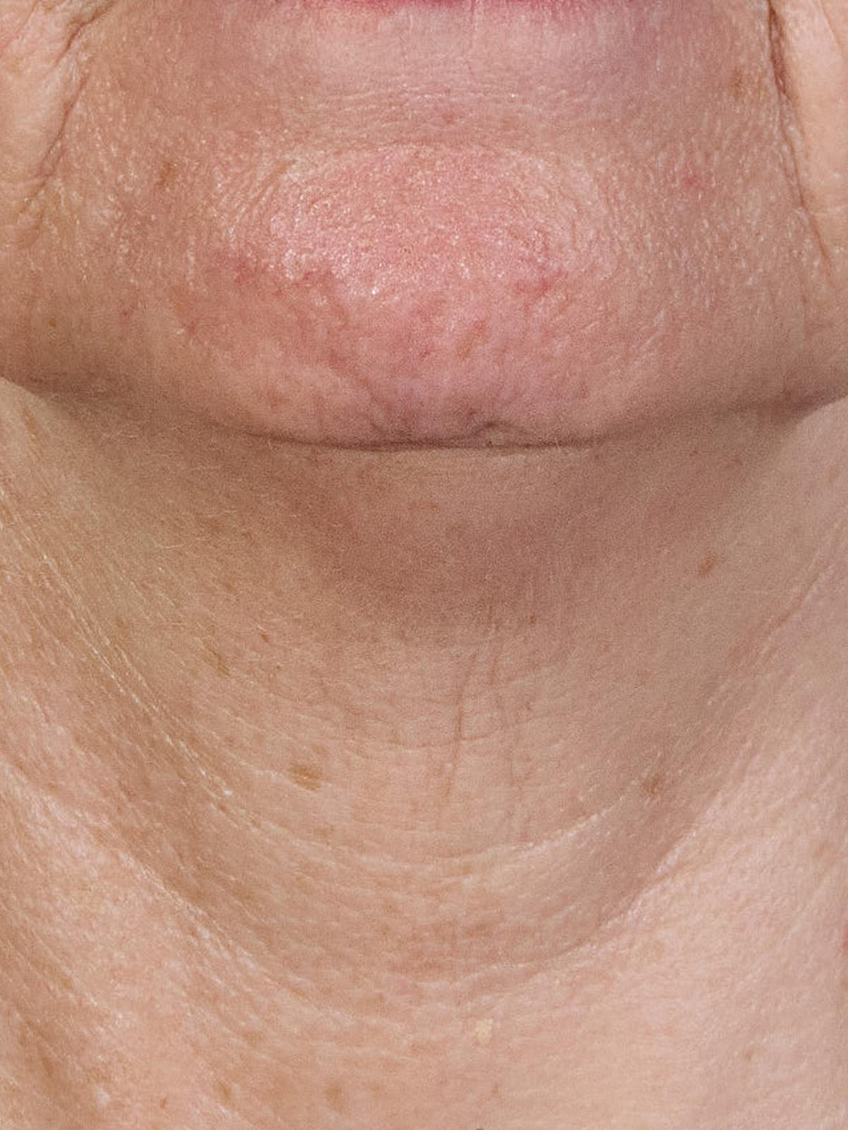 Result after only 4 weeks of use