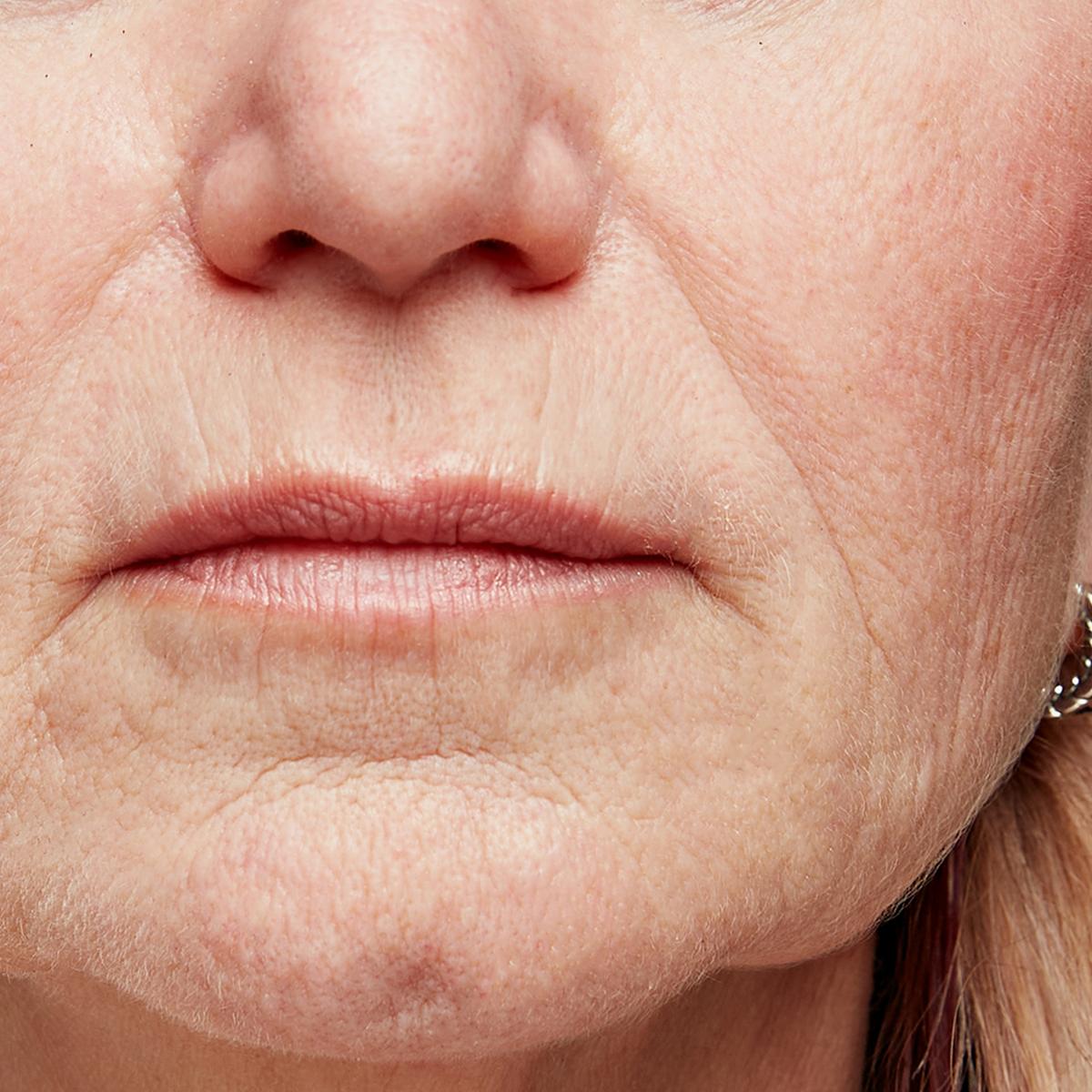 Beschrijving afbeelding 2