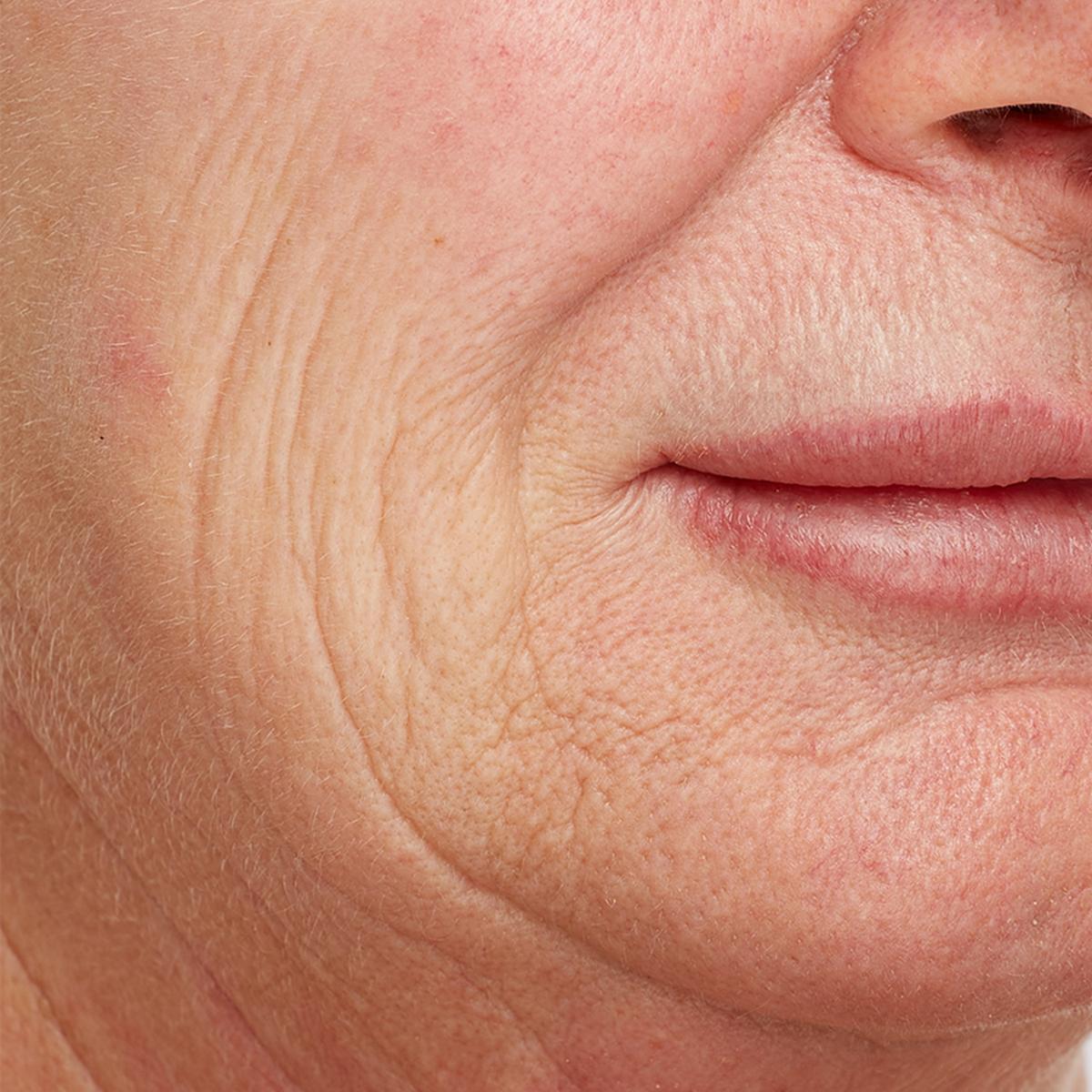 Beschrijving afbeelding 1