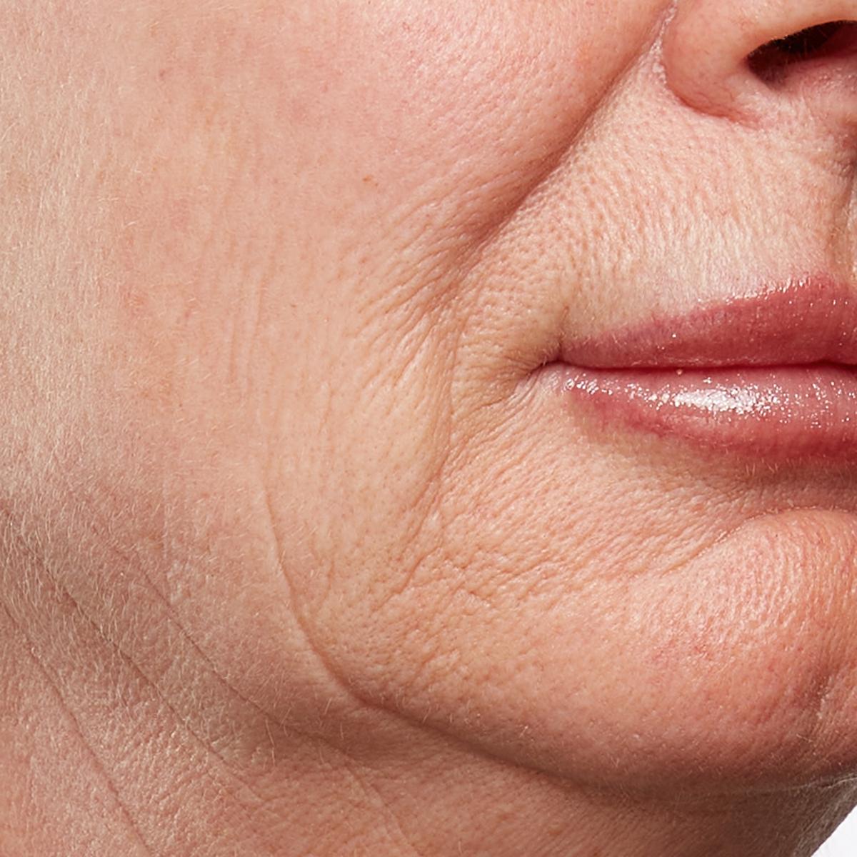 Beschrijving afbeelding 2