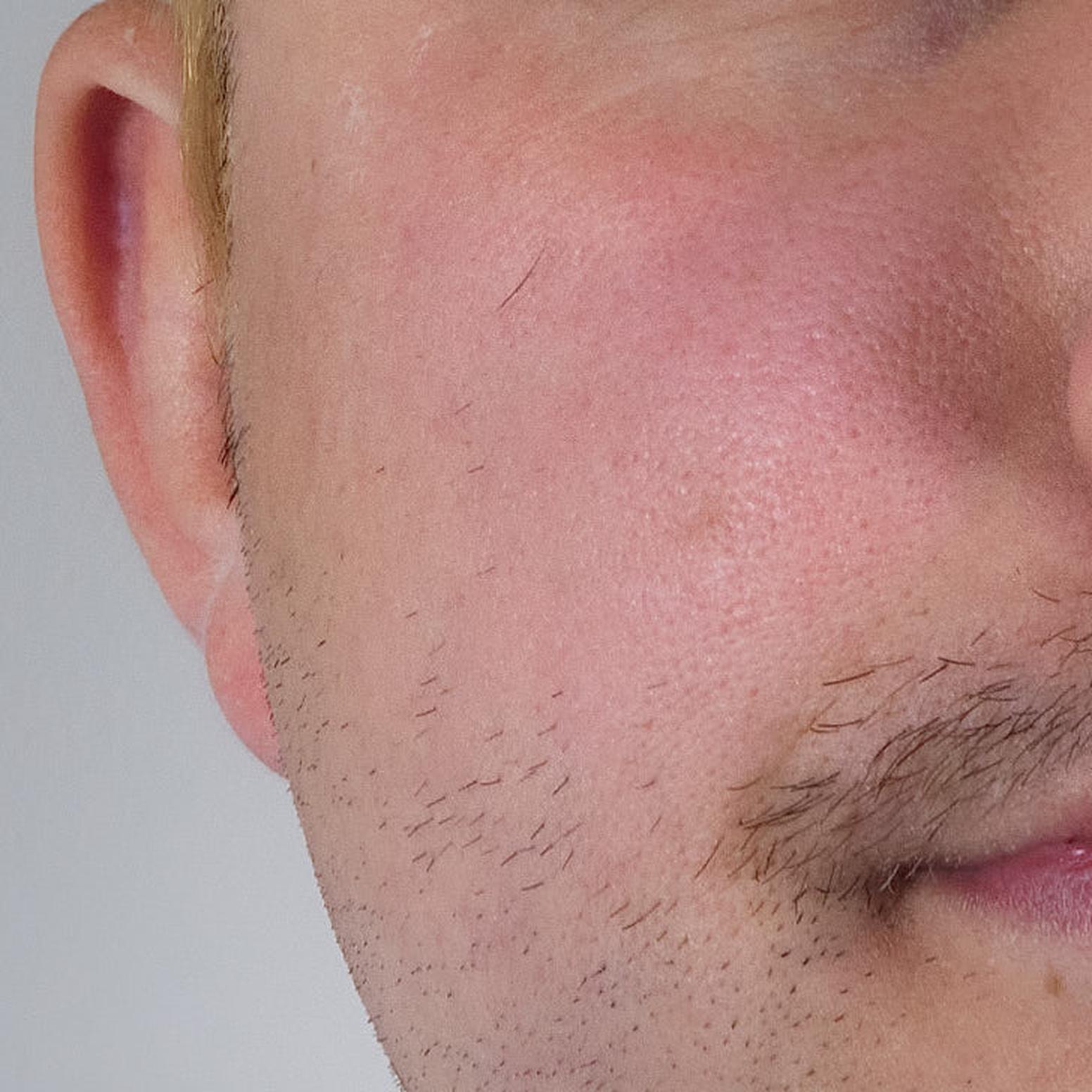 Result after only 4 weeks of use